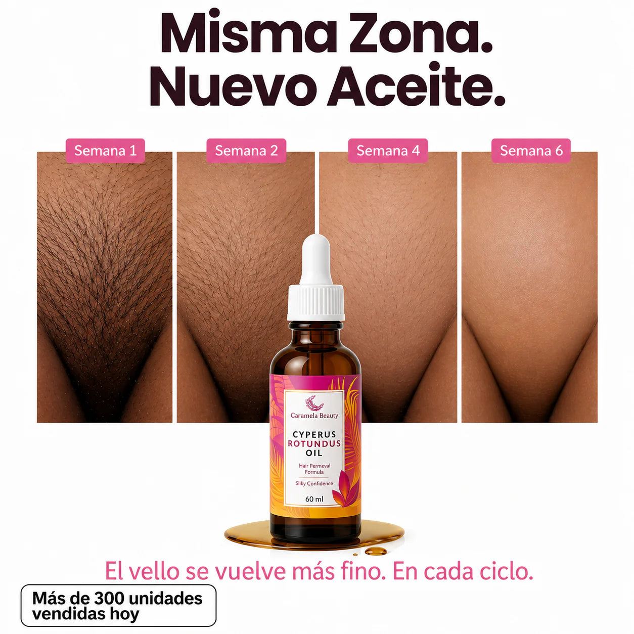 ACEITE NATURAL CYPERUS ROTUNDUS™ | Ayuda a Retrasar el Crecimiento del Vello