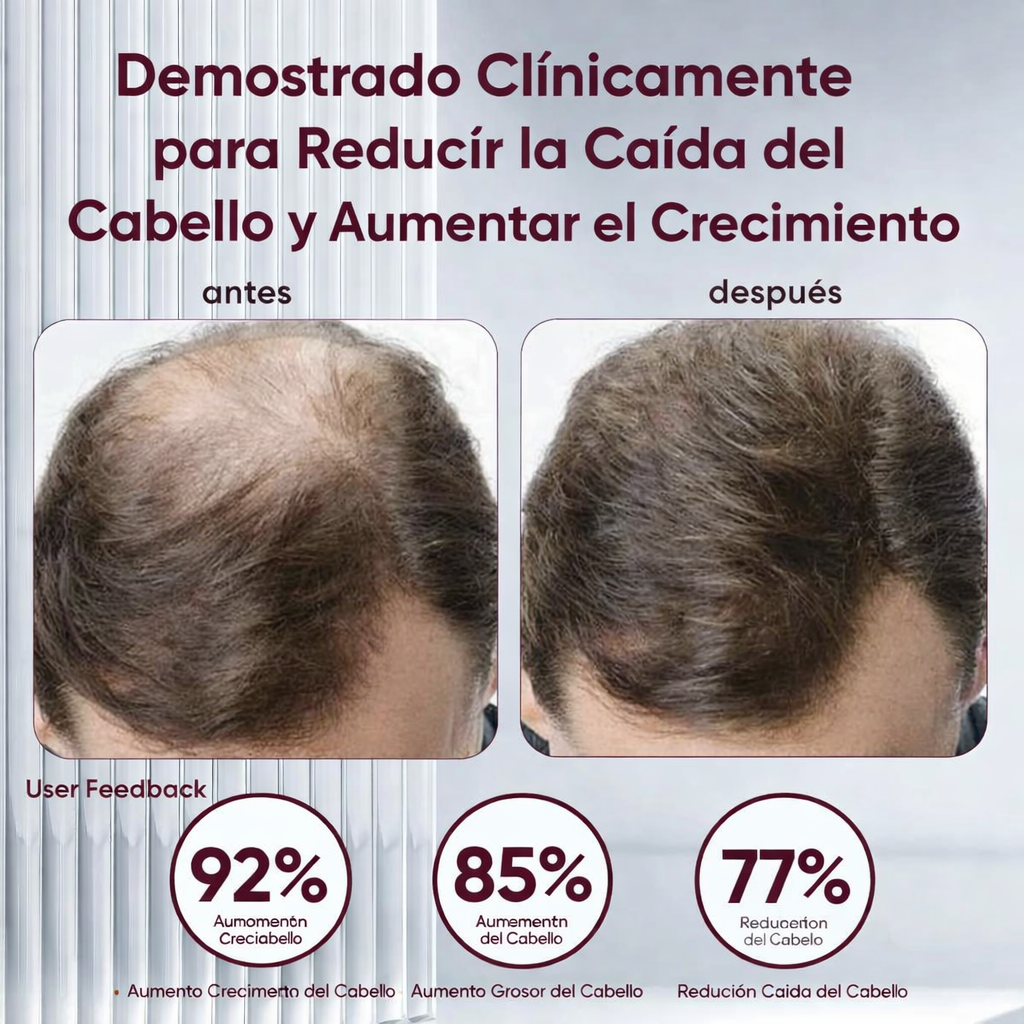 EXCALVO: CONTROLA LA CAÍDA DESDE LA RAÍZ